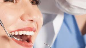 The Benefits of Professional Teeth Whitening in Irvine: Why It’s Worth It