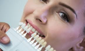 Transform Your Smile with Dental Implants in Atlanta, GA: A Comprehensive Guide