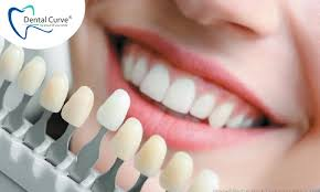 Transform Your Smile with Invisalign in Edmonton: Affordable Solutions for a Confident You